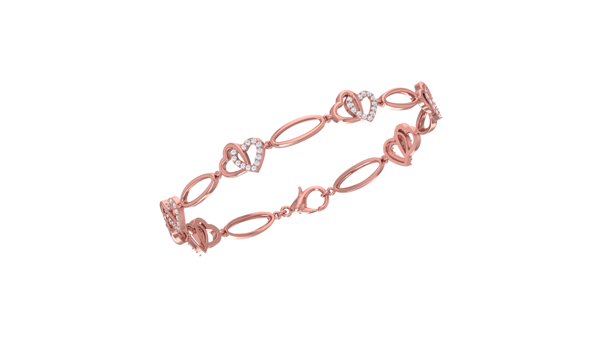 rose gold